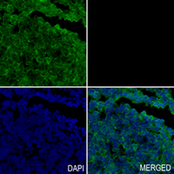 ATG4A Rabbit Monoclonal Antibody