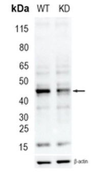 ATG4A Rabbit Monoclonal Antibody