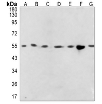 SLC7A11 Rabbit Monoclonal Antibody