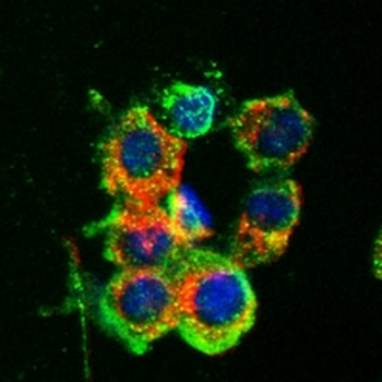SLC7A11 Rabbit Monoclonal Antibody