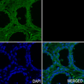 CD55 Rabbit Monoclonal Antibody