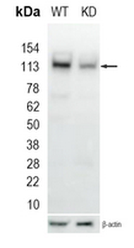 CD51 Rabbit Monoclonal Antibody