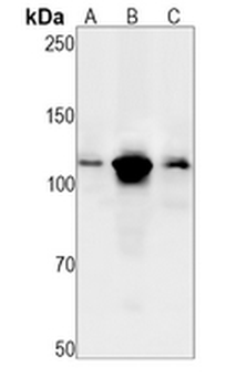 PARP1 Rabbit Monoclonal Antibody
