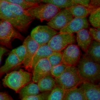 PARP1 Rabbit Monoclonal Antibody