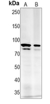 FOXP1 Rabbit Monoclonal Antibody