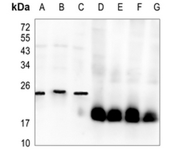 SOD1 Rabbit Monoclonal Antibody