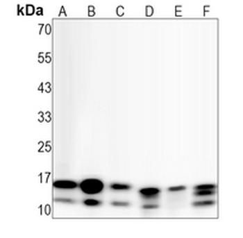 LC3B Rabbit Monoclonal Antibody