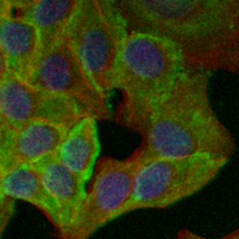 LC3B Rabbit Monoclonal Antibody