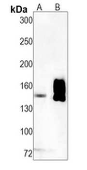 CD49e Rabbit Monoclonal Antibody