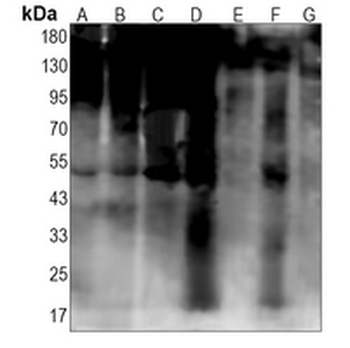Ubiquitin (Linkage specific-K48) Rabbit Monoclonal Antibody