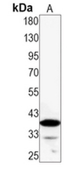 AMPK beta 1 Rabbit Monoclonal Antibody