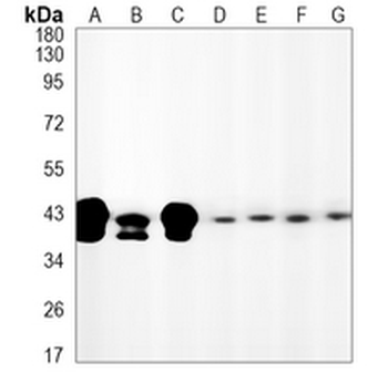 JUNB Rabbit Monoclonal Antibody