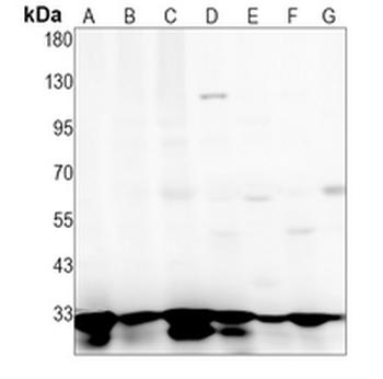 Cyclin D3 Rabbit Monoclonal Antibody