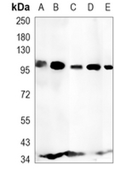 CD10 Rabbit Monoclonal Antibody