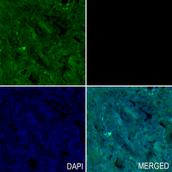 CD10 Rabbit Monoclonal Antibody