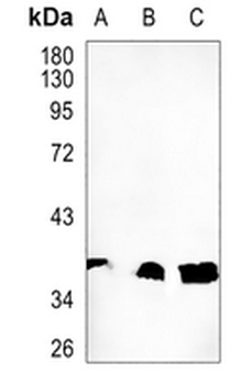 AMPK gamma 1 Rabbit Monoclonal Antibody