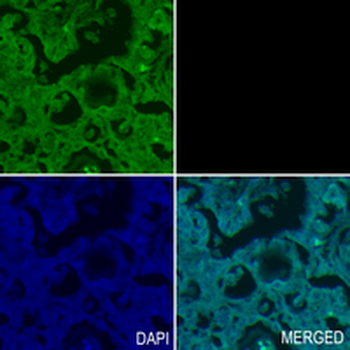 AMPK gamma 1 Rabbit Monoclonal Antibody