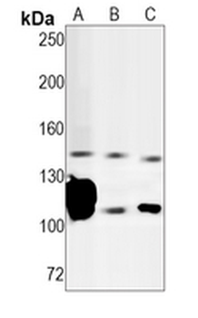 CD21 Rabbit Monoclonal Antibody