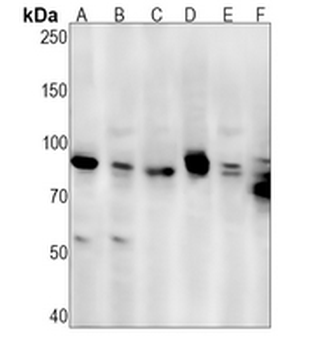IKK alpha/beta Rabbit Monoclonal Antibody