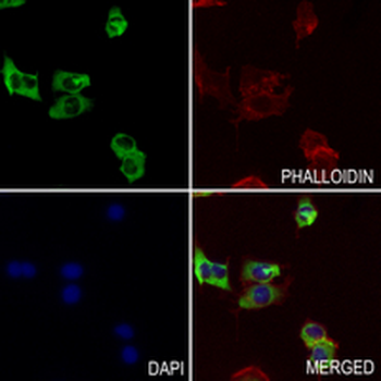 IKK alpha/beta Rabbit Monoclonal Antibody