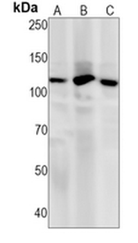 PI3K p110 beta Rabbit Monoclonal Antibody
