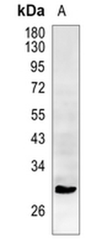 Aquaporin 5 Rabbit Monoclonal Antibody