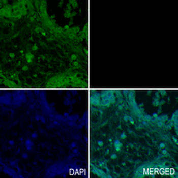 Aquaporin 5 Rabbit Monoclonal Antibody