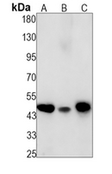 Cyclin E2 Rabbit Monoclonal Antibody