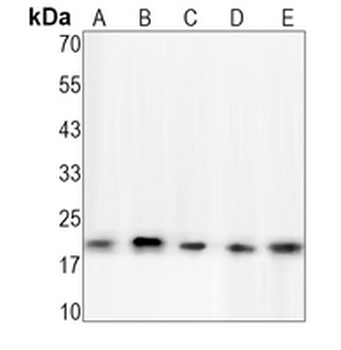 NRAS/HRAS/KRAS Rabbit Monoclonal Antibody