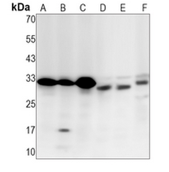 Caspase 3 Rabbit Monoclonal Antibody