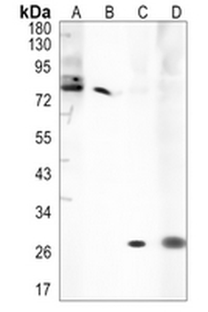 CD263 Rabbit Monoclonal Antibody