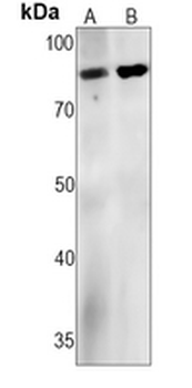 PI3K p85 alpha Rabbit Monoclonal Antibody