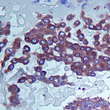 PI3K p85 alpha Rabbit Monoclonal Antibody
