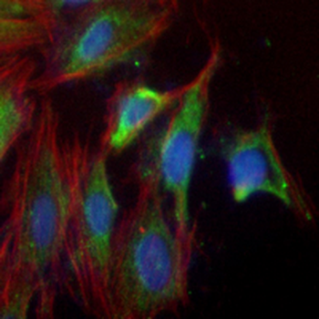 PI3K p85 alpha Rabbit Monoclonal Antibody