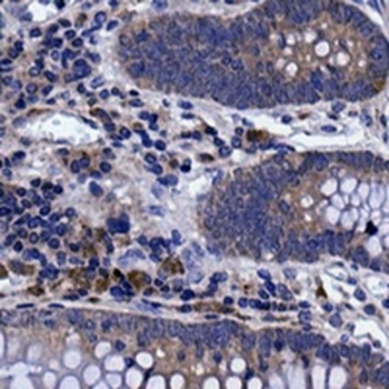 PARP1 (Cleaved-D214) Rabbit Monoclonal Antibody