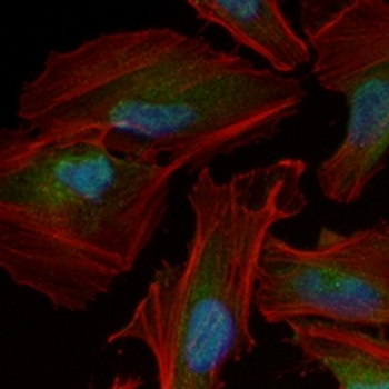 PARP1 (Cleaved-D214) Rabbit Monoclonal Antibody