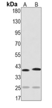 Synaptophysin Rabbit Monoclonal Antibody