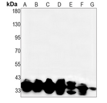 CDC2 Rabbit Monoclonal Antibody
