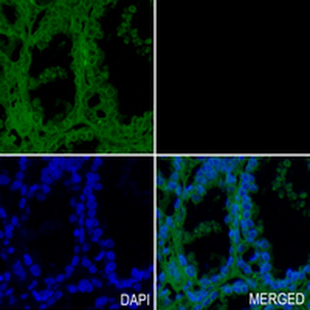 CD29 Rabbit Monoclonal Antibody