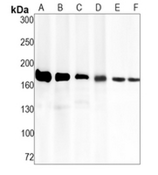 VEGFR1 Rabbit Monoclonal Antibody