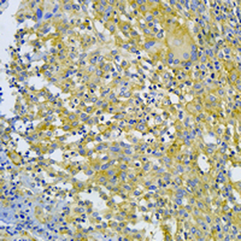 VEGFR1 Rabbit Monoclonal Antibody