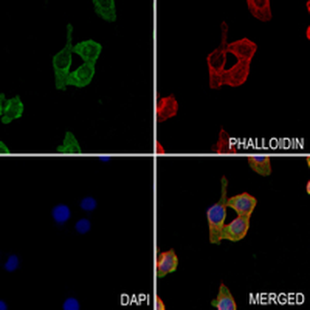 VEGFR1 Rabbit Monoclonal Antibody
