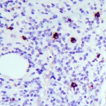 CD44 Rabbit Monoclonal Antibody