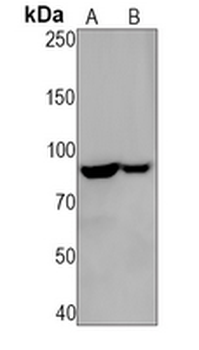 FOXO3 Rabbit Monoclonal Antibody