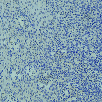FOXO3 Rabbit Monoclonal Antibody