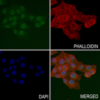 EGLN2 Rabbit Monoclonal Antibody