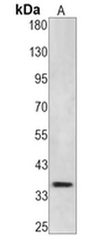 CDC2 Rabbit Monoclonal Antibody
