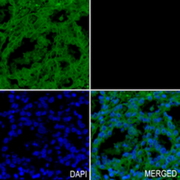 CDC2 Rabbit Monoclonal Antibody