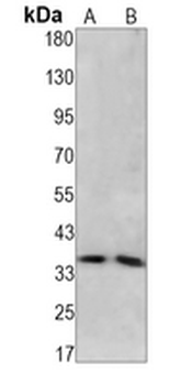 Caspase 3 Rabbit Monoclonal Antibody