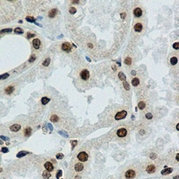 PARP1 (Cleaved-D214) Rabbit Monoclonal Antibody